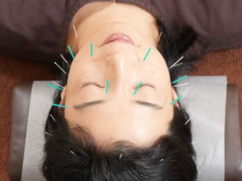 ゆり鍼灸院/美容鍼