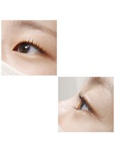 アイラッシュ ラナフル(Lanaful)/マツパ☆