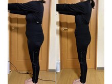 ヨサパーク 指扇店(YOSA PARK)/全身痩せ＆ボディメイク