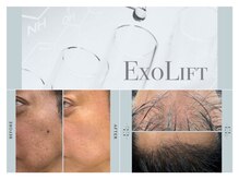 ベッロルーチェ 国立店(belloluce)の雰囲気(《医師監修》毛穴、くすみ、引き上げに)