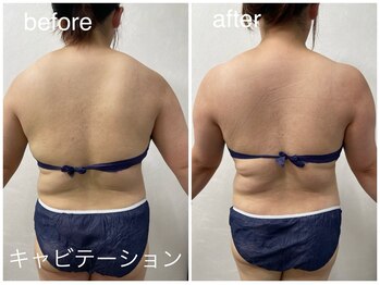 レイドアンドゴールドパレス(Reid&Gold Palace)/EMSで姿勢も改善