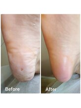 リゼラアンドコー 宇都宮陽南店/ドイツ式フットケア専門店