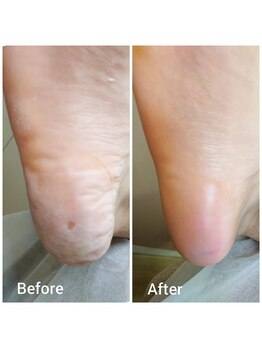 リゼラアンドコー 宇都宮陽南店/ドイツ式フットケア専門店