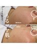 ☆NEW☆ 【フルフェイシャルワックス脱毛】眉デザイン込
