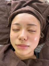 エムアイ 六本木(Mi)/ララピールゲルパック