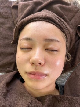 エムアイ 六本木(Mi)/ララピールゲルパック