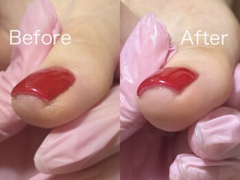 ネイルズ バイ ユイ 外苑前(Nails by Yui)/角質除去してすっきり