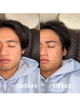 ランド(LAND)/【メンズ】HBL＋眉wax