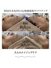 マイレ 平塚店(Maile)/エイジングケア