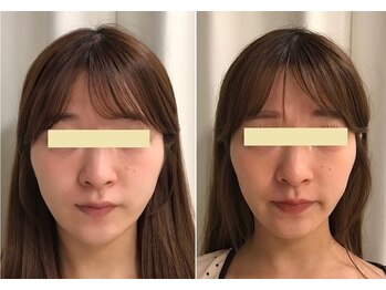 ナチュレアンドメディカ(Nature&Medica)/オンダフェイス「会員様6回目」