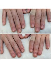 シャンネイルケアサロン(Shan Nail caresalon)/ハードジェル自爪保護コース