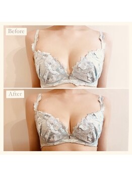 アンシャンテ(ENCHANTER)/光バストアップ