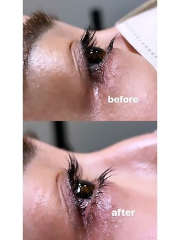 ループ(LOOP)/下まつ毛パーマ