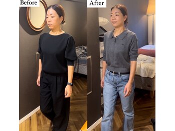 コルミチョン サロン(骨美整 salon)/40代女性　歩き方Before・After