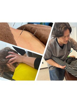 鍼灸施術を受けたい