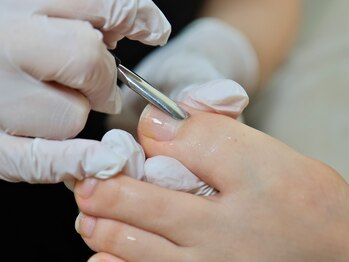 爪表面の角質ケア