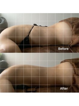 アサヒナ(ASAHINA)/30代のお客様ビフォーアフター