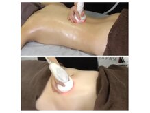 温熱機器施術でコリもお疲れも脂肪もスッキリ♪温活・眠活・腸活