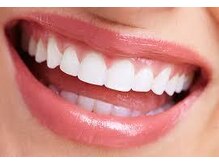 歯の黄ばみを白くするセルフホワイトニングで、笑顔が映える