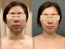 メグムサロン(Megumu Salon)の雰囲気（角質ケア＋空ルート（整体・骨格矯正）のコースが1番人気です☆）