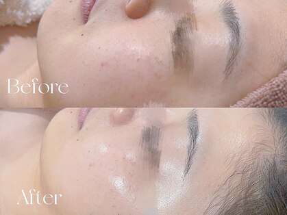 ウィハナ(wehana)の写真