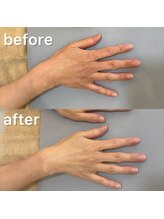 オテテ アイアンドハンド(otete eye&hand)/ハンドケアビフォーアフター