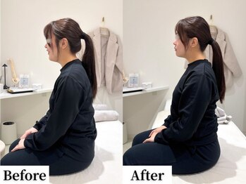 ソレア(Solea)/猫背・肩甲骨改善1回目