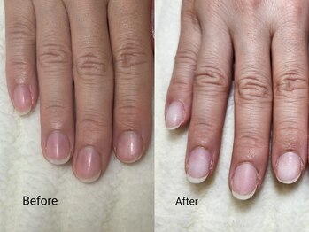 グラシナ なんば店/深爪/自爪育成/フィルイン