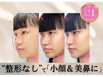 小顔 隆鼻矯正専門店 ラプリアモル(Raplit amor)/回数を重ねるごとに変化していく