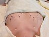 【1回でも効果実感】根本改善鍼×◇2サイズUPを目指す育乳鍼集中コース