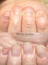 マリーロール 梅田店(Marie Laure)/自爪育成/深爪矯正/ネイルケア