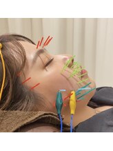 恵比寿すこやか鍼灸整骨院/リフトアップ特化型美容鍼