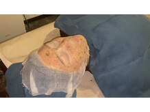 サロンズ ホット スパ ラニ(SALON'S HOT SPA Lani)の雰囲気（お客様に大人気！5日間で肌質改善！！ハーブピーリング☆）