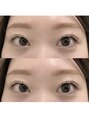 バニーアイズ 天神(Bunny eyes TENJIN) ラッシュリフトの部分的な細かいご要望もご相談ください♪