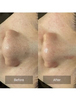 ゴホウビ オキナワ(GOHOBI OKINAWA)/毛穴レスな美肌へ♪