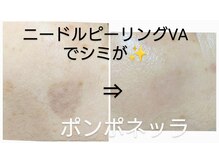 ポンポネッラ