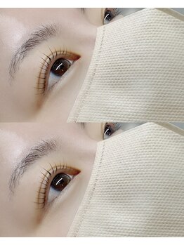 ラウレア(LAULEA)/コスメリフト