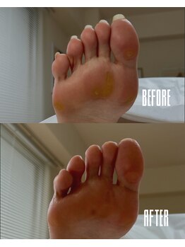 おん/タコの中に魚の目