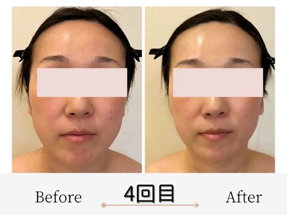 エミフル(emifull)の写真