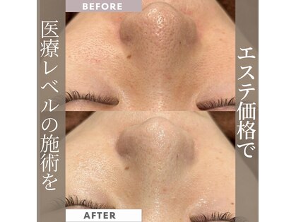 レア 姫路店(le'a)の写真