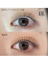 ロイ(ROI)/まつげパーマ　ビフォーアフター