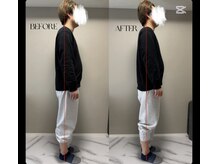 春日整体院ito/【姿勢改善ビフォーアフター】