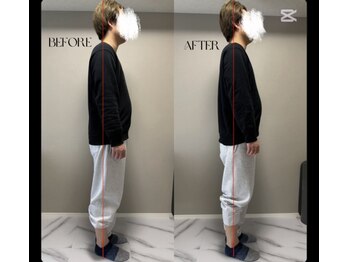 春日整体院ito/【姿勢改善ビフォーアフター】