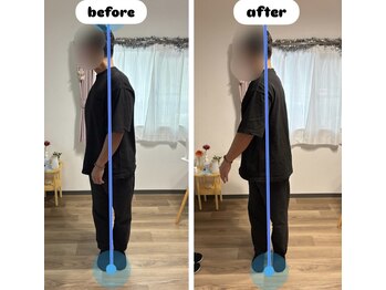 カラダリリース 浜松店/腰痛施術効果比較