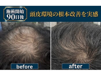 ヴァルク 名古屋店(VA LK)の写真/毛穴・ベタつき・乾燥を徹底ケア♪メンズの髪質に合わせた「幹細胞ジェット」で、潤い満ちる透明美肌へ！