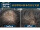 ヴァルク 名古屋店(VA LK)の写真/毛穴・ベタつき・乾燥を徹底ケア♪メンズの髪質に合わせた「幹細胞ジェット」で、潤い満ちる透明美肌へ！