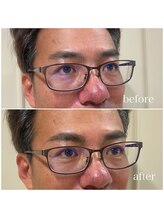 爪屋べっぴん堂/アイブロウマッピング