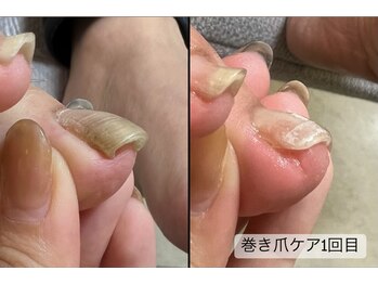 ユマニ バイ ヒート(Humani by HEAT)/