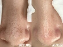 サロン ムスブ(salon MUSUBU)/山梨エステ/甲府エステ