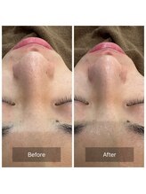 ゴホウビ オキナワ(GOHOBI OKINAWA)/毛穴が締まるとトーンも上がる♪